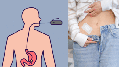 Gastroshiza